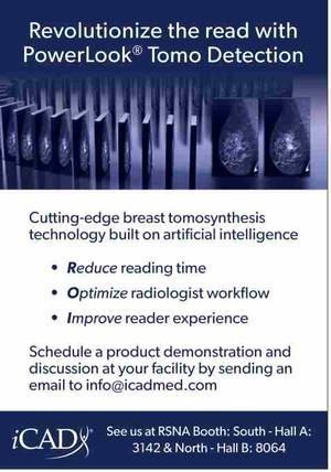 Revolutionize the read wi