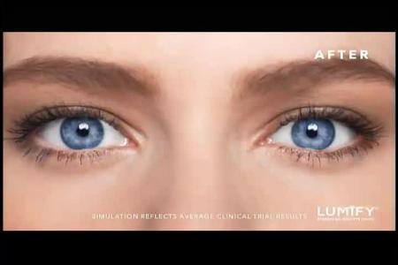 Bausch & Lomb - Lumify
