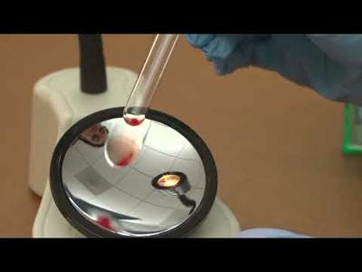 Reading and Grading of Tube Testing Demonstration