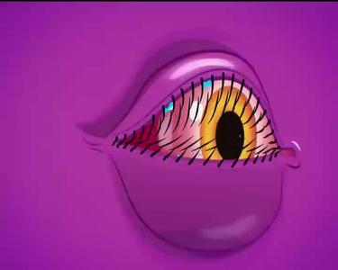 Horizon Therapeutics - Thyroid Eye Disease