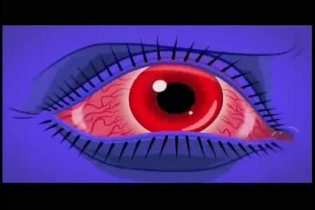 Horizon Therapeutics - Thyroid Eye Disease