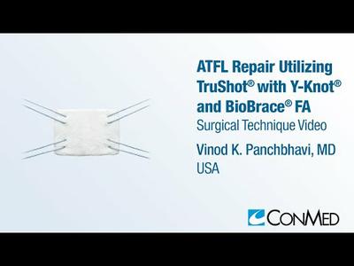 Dr. Vinod Panchbhavi - ATFL Repair Utilizing TruShot® FA with Y-Knot® and BioBrace® FA - CONMED