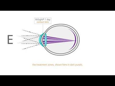 ActivControl Technology
