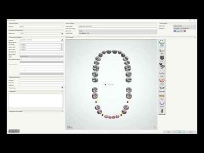Novaloc® Digital – How to go through the Implant Level Order Form?