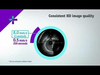 The AVVIGO+ Multi Guidance System -  Boston Scientific