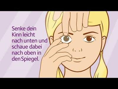 Absetzen der MiSight 1 day Einmalkontaktlinsen